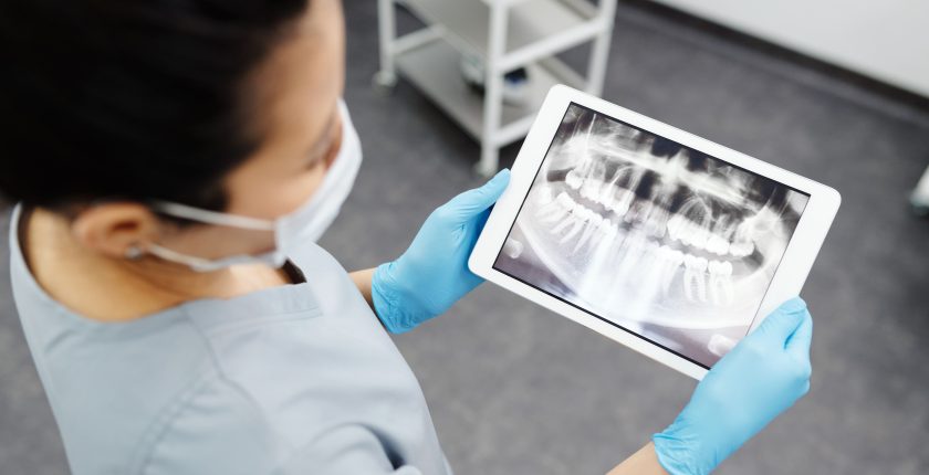 Digital Dentisty, dentist holding scan of teeth